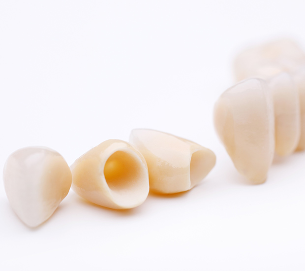 Dallas Dental Crowns and Dental Bridges