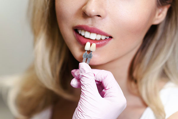 How Effective Are Dental Veneers? from Highlands Family Dentistry in Dallas, TX