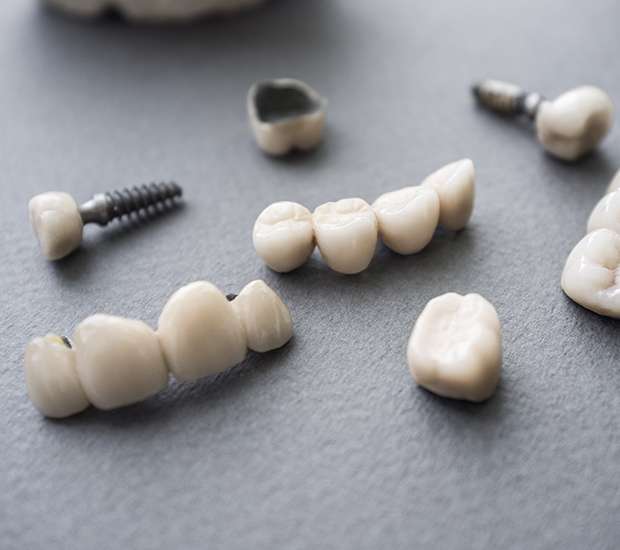 Dallas The Difference Between Dental Implants and Mini Dental Implants