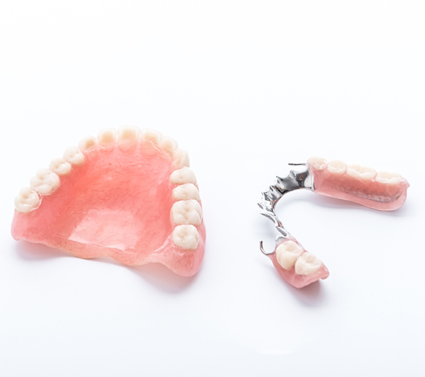 Dallas Partial Dentures for Back Teeth