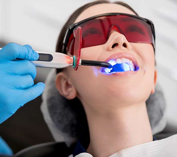 Dallas Professional Teeth Whitening